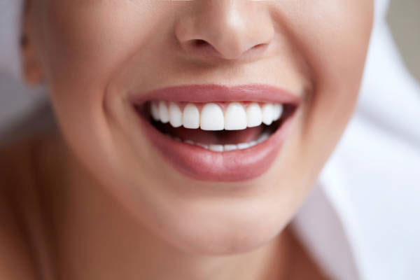 Gülüş ve Dudak Tedavisi (Gummy Smile)